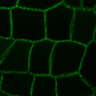 The receptor kinase SUB contributes to cell wall surveillance. Here you see SUB:EGFP signal at plasma membrane and plasmodesmata (PD)