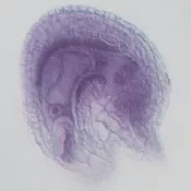 Optical section through a mature wild-type ovule.